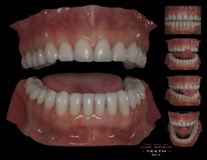 Luc Begin Realistic 3D Teeth Model